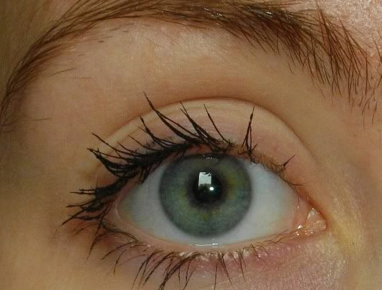 ogen voor iridotomie